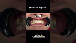 Miami Smile Makeover! ✨ Dental Blush Transformation