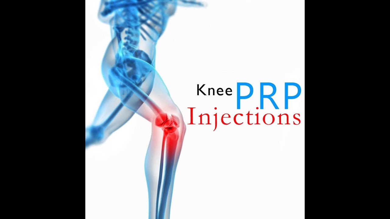 Knee pain nonsurgical treatment PRP treatment for knee