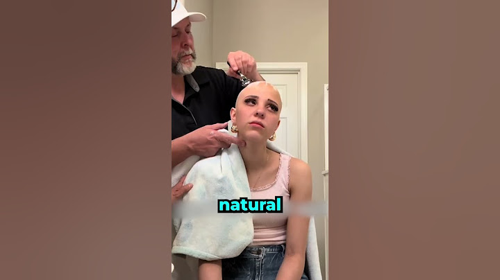 She had to cut her hair off because of her condition 😢