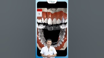 Niềng Răng Invisalign | Bác Sĩ Yên