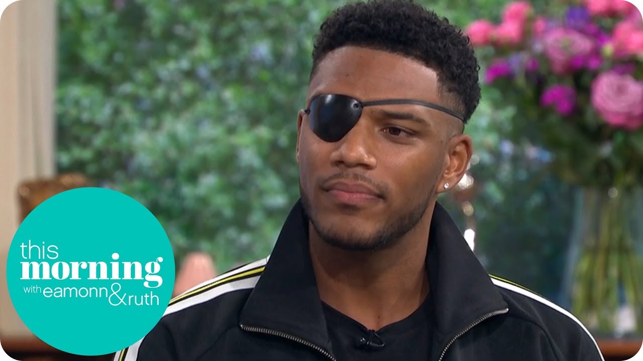 Love Island's Theo on the Champagne Cork Accident That Left Him Blind ...
