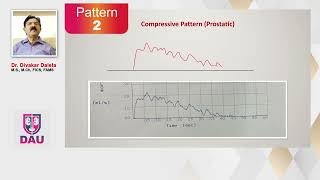 Uroflowmetry How to interpret Flow Patterns