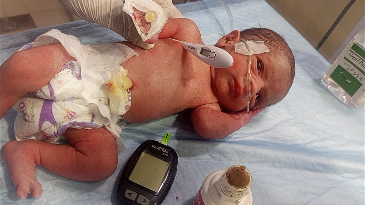 Newborn Care Guide: Cord Care + Temperature Monitoring + RBS Check + Skin Care