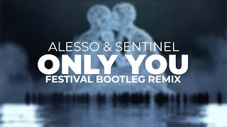 Alesso & Sentinel - Only You (H Lazer Festival Bootleg) [Free Download]