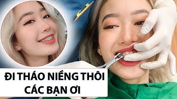 Hành trình tháo mắc cài niềng răng - Hồi hộp hơn cả lấy chồng