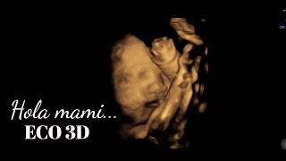 Eco 3D + Como se llamará nuestro bebé?? @vlogsdeandy