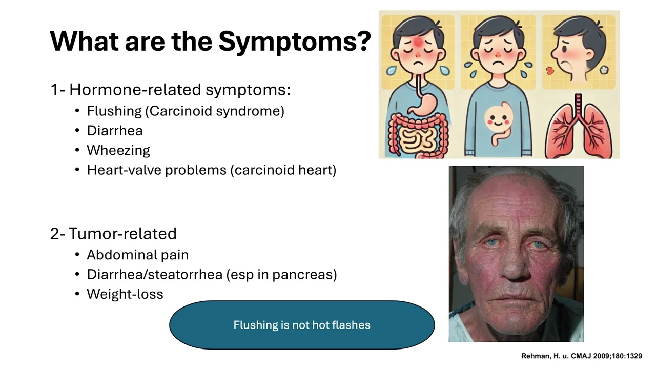 Newly Diagnosed