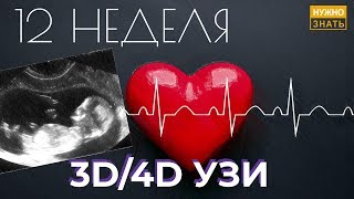 12 неделя беременности. Развитие плода. УЗИ в 3D. Как выглядит ребенок на 12 неделе