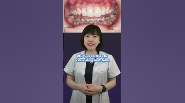 Niềng răng một hàm có được không? | Dr Anh Thư