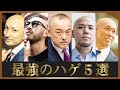 【国宝級】ハゲてもかっこいい男達5選 | ハゲを武器に変えたその方法とは