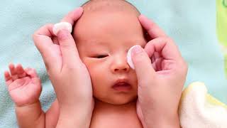 Bebeklerde gözyaşı kanalı tıkanıklığı nedir? - Prof. Dr. Abdullah Özkaya (Göz Merkezi) Resimi