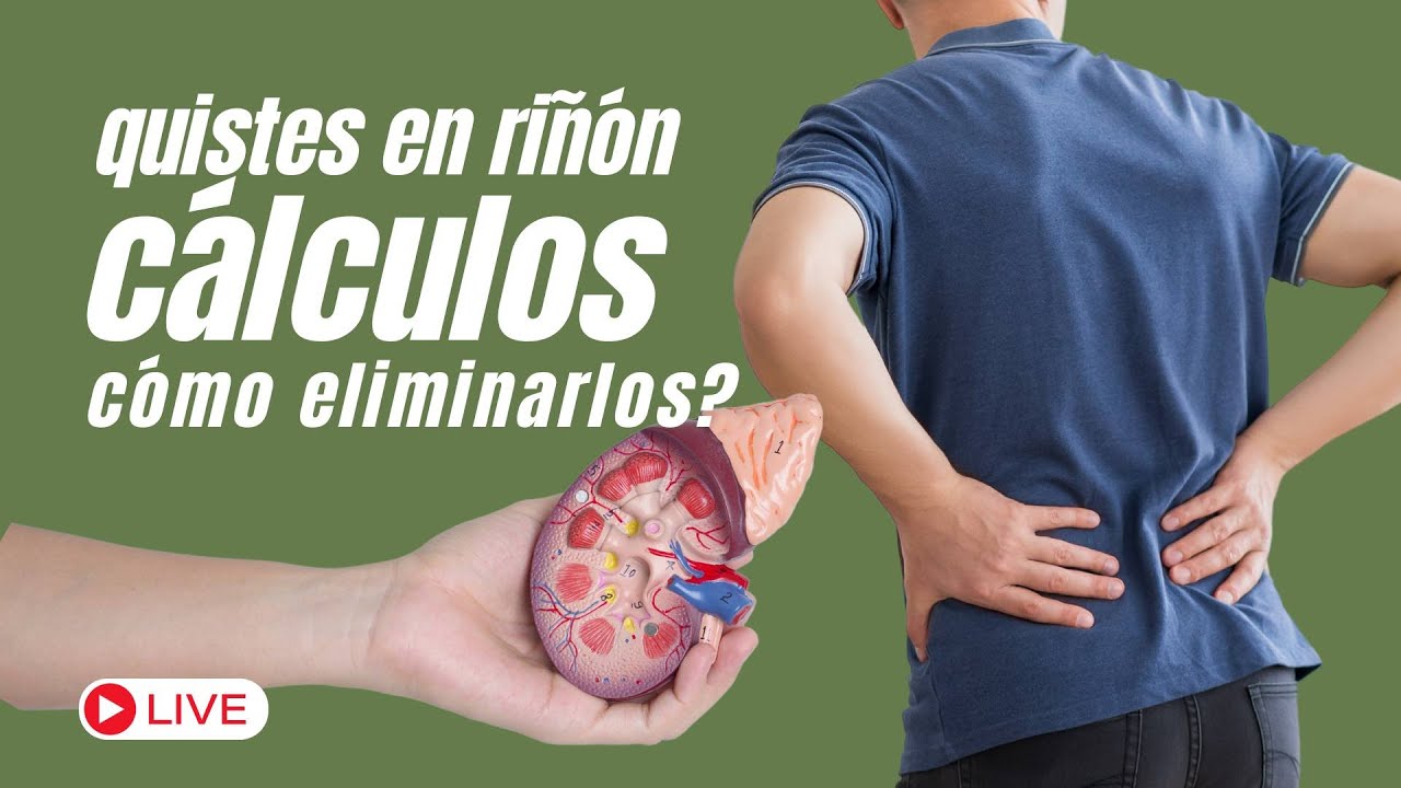 Quistes en RIÑÓN, CÁLCULOS: Cómo eliminarlos? | Acupuntura_Emociones ...