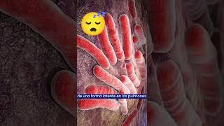 ¿Qué es la TUBERCULOSIS y cuáles son sus SÍNTOMAS? #tuberculosis #enfermedadesrespiratorias