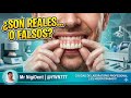 Todo lo que debes saber sobre las prótesis dentales parte 6