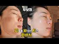 모공·기미·여드름… 이 관리 하나로 싹 정리됐습니다 (무보정 시술 전후) 피부를 바꾸는 시간의 피바시