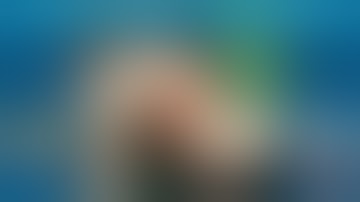 02 Fixation of Proximal Tibia Fracture Through Arthrotomy Approach Trailer