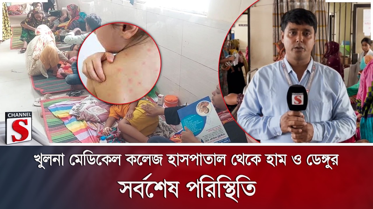 খুলনা মেডিকেল কলেজ হাসপাতাল থেকে হাম ও ডেঙ্গুর সর্বশেষ পরিস্থিতি | | Channel S News