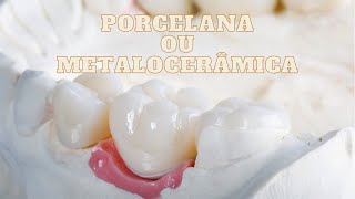 COROA DE PORCELANA OU METALOCERÂMICA? QUAL FAZER?