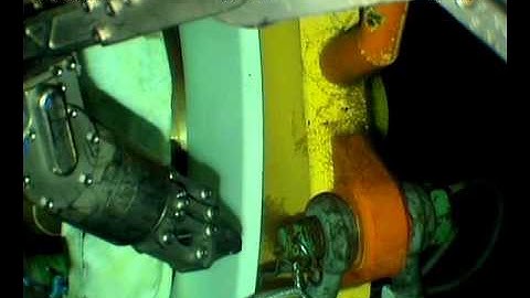 R Clip Install and Removal from Arm Video 1