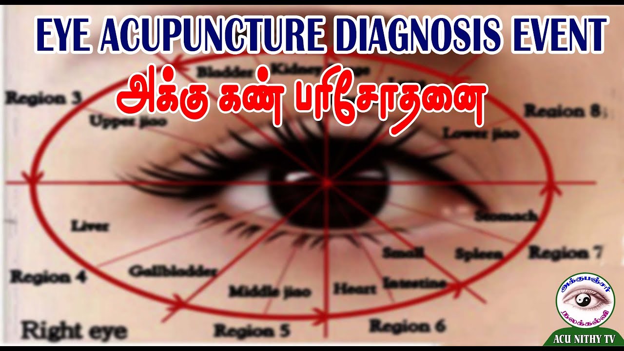 அக்கு கண் பரிசோதணை (ACUPUNCTURE EYE DIAGNOSIS) YouTube