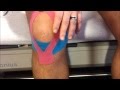 How To: Kinesiology Self Taping for Knee Pain