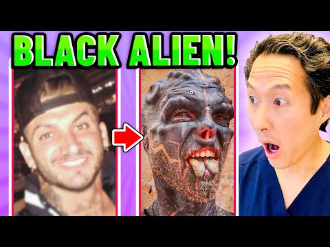 Plastic Surgeon Reacts to BLACK ALIEN PROJECT! Extreme Bodies Explained!