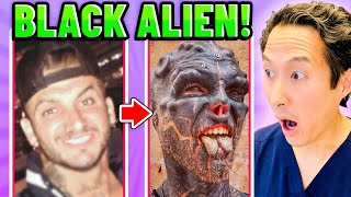 Plastic Surgeon Reacts To Black Alien Project Extreme Bodies Explained