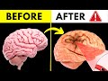 The 6 alarming signs of a stroke you must know