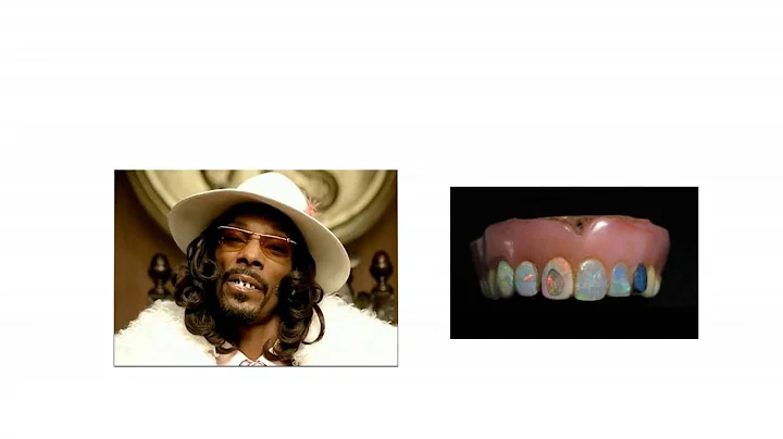 Harold Hodge And His Opal Teeth