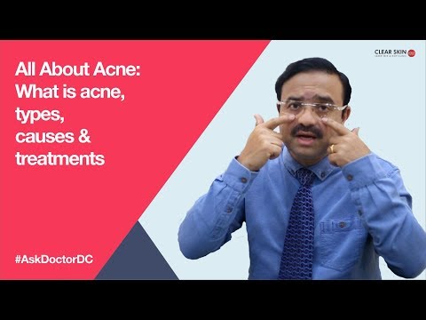 All About Acne: What is acne, types, causes & treatments (English)