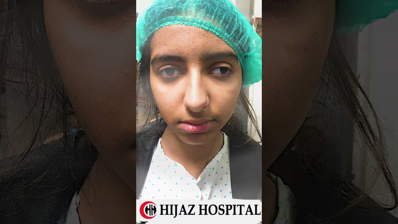 A Successful Squint Surgery