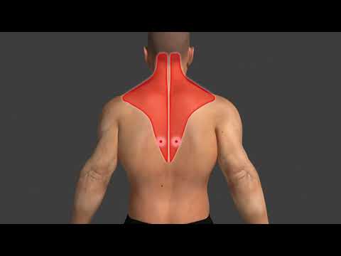 ტრიგერული წერტილები როგორც ძლიერი ტკივილის წარმოქმნის მიზეზი კუნთებში