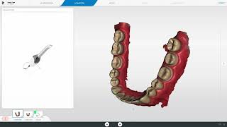 How to Export / Import CEREC cases to open on MiniCADPC Workstation running v5.2