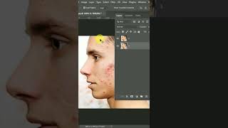 How to remove pimples from face photoshopedit photography @Shinetechtelugu