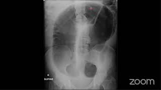 A structured approach, common cases and pitfalls to Abdominal and Pelvis X Rays