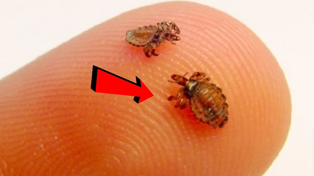 Bitlərdən 1 günə qurtulun – Analar baxsın