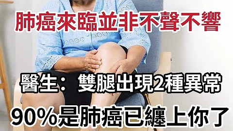 爸妈腿疼要警惕！医生提醒：双腿出现这2种异常，你可能已经被肺癌缠上了，早知道能救你一命 - 天天要闻