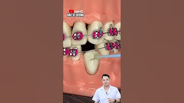 Răng mọc lệch |Dr Cường Official