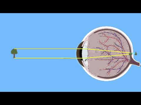 Video: Anamorphotische Linse: Was Ist Das? Arten Von Aufsätzen Und Tipps Für Ihre Verwendung