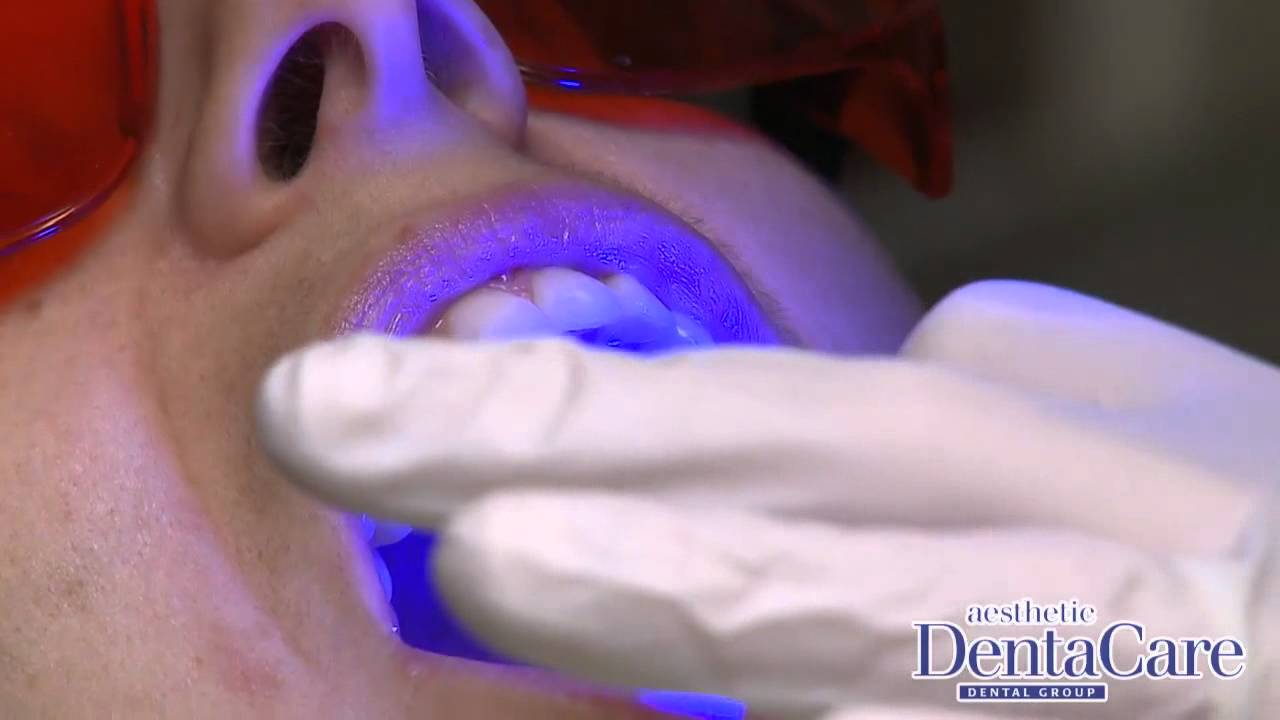 Dentist Devon Edmonton DentaCare Dental Group AB