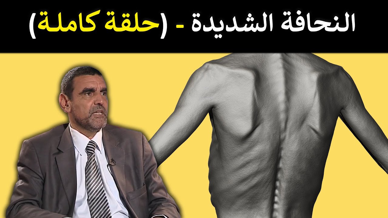 🔹 النحافة الشديدة / الحلول الغذائية لزيادة الوزن بطريقة صحية 🍚 د. محمد الفايد 🌴 #برنامج_نخل_ورمان