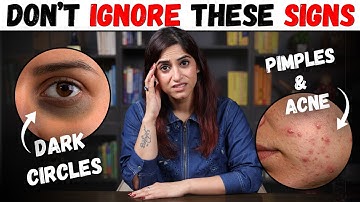 Find out the reason of your Acne and Pimples and Fix them permanently | By Gunjanshouts