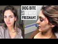 DOG BITE AT 20 WEEKS PREGNANT! | Paige Danielle