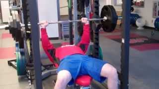 Triphasic Upper Body Lift