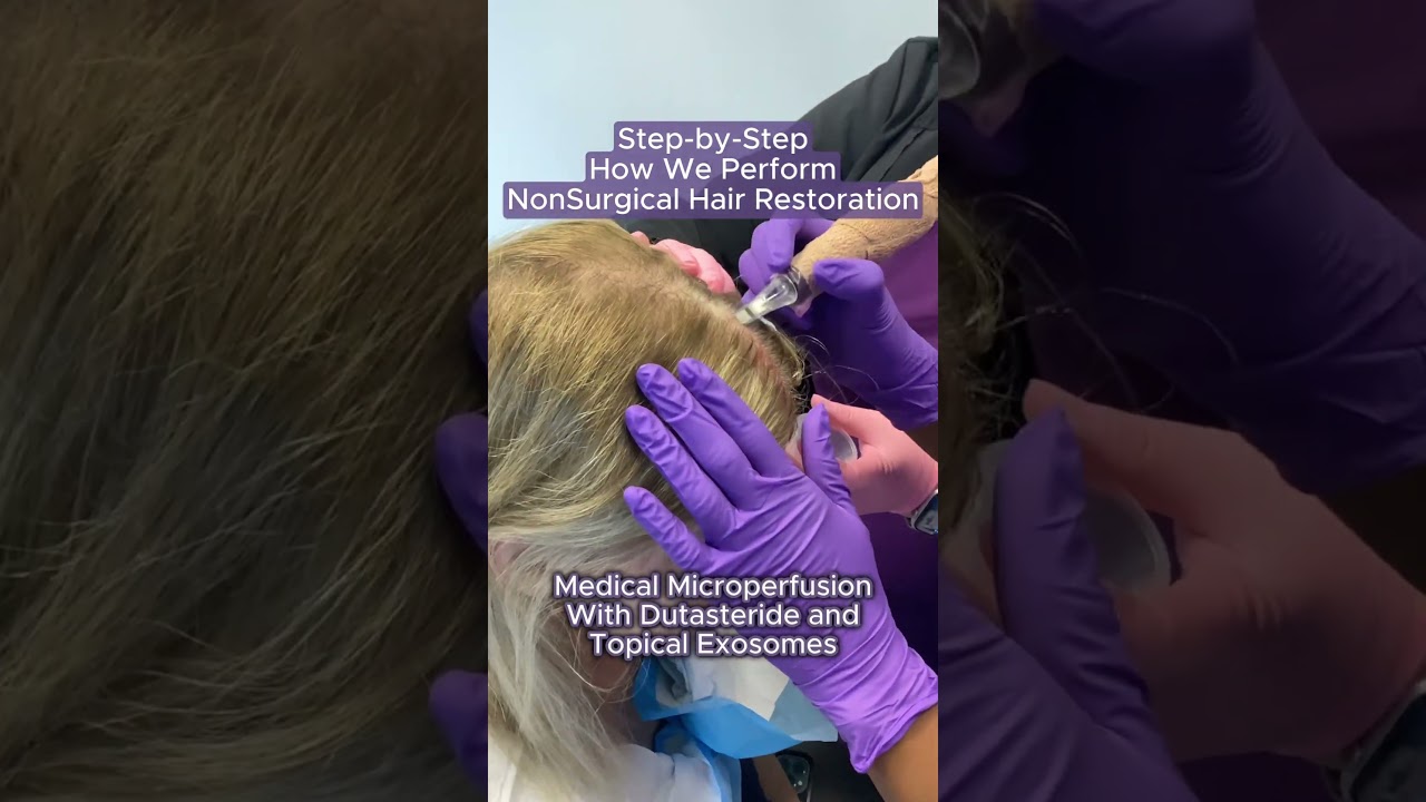 Biostimulatory growth factor hair loss treatments 