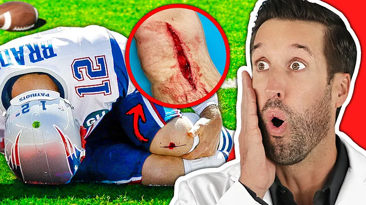 ER Doctor REACTS to WORST NFL Football Injuries #2