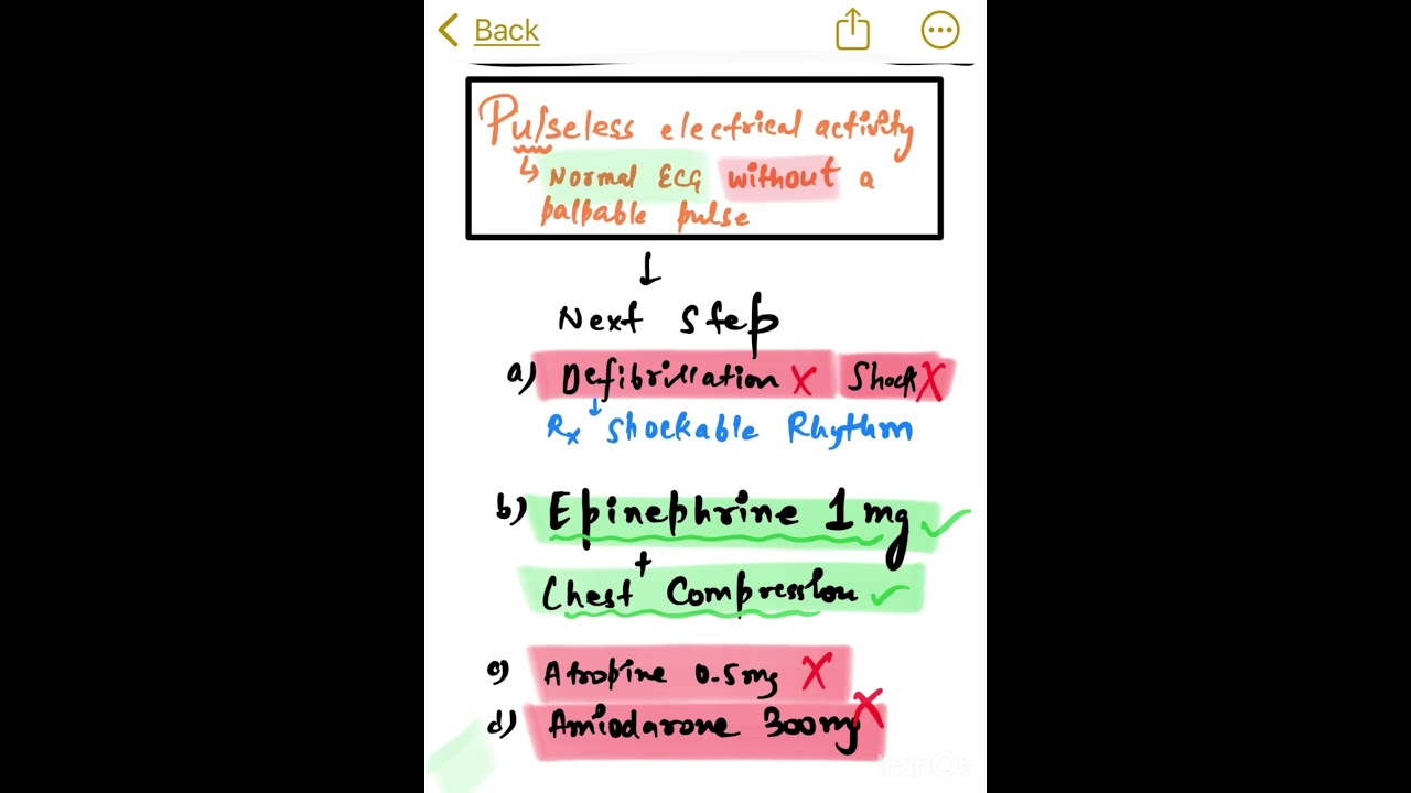 Non shockable rhythm - Pulseless electrical activity , Asystole  HYT / PYT/ INICET/ NEETPG/ FMGE