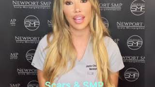 Scars and scalp micropigmentation