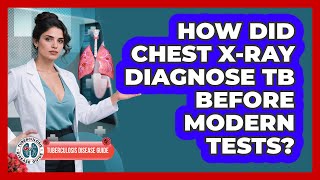 How Did Chest X-ray Diagnose TB Before Modern Tests? - Tuberculosis Disease Guide