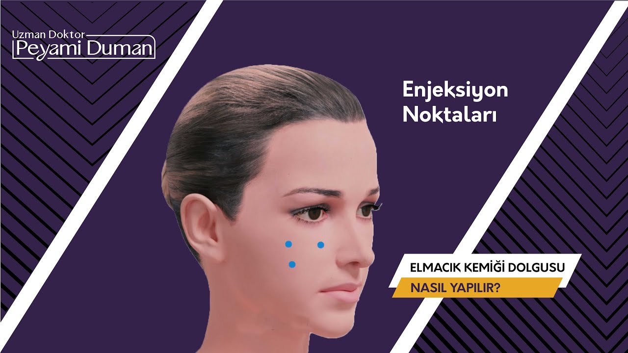 elmacık